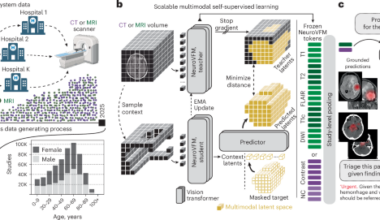 Health system learning enables generalist neuroimaging models