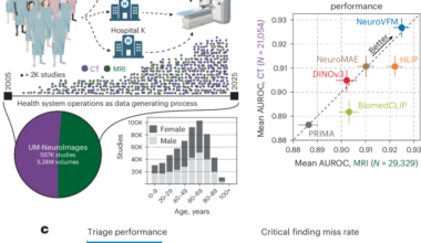 Learning from routine health system data builds better neuroimaging AI models