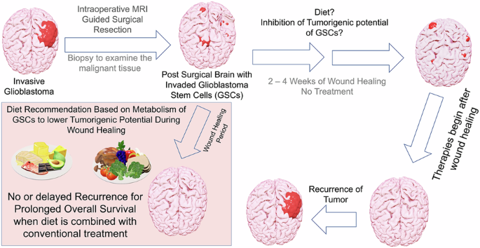 Low carbohydrate high fat diet curbs glioblastoma by shifting lipids and limiting cancer stem cell metabolic flexibility
