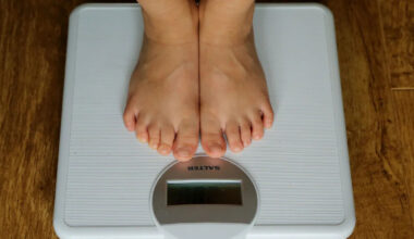 Obesity in Guernsey needs 'whole systems approach'