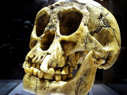 A replica of H. floresiensis' skull and teeth. Credit: Gerbil/Wikimedia Commons A replica of H. floresiensis' skull and teeth.