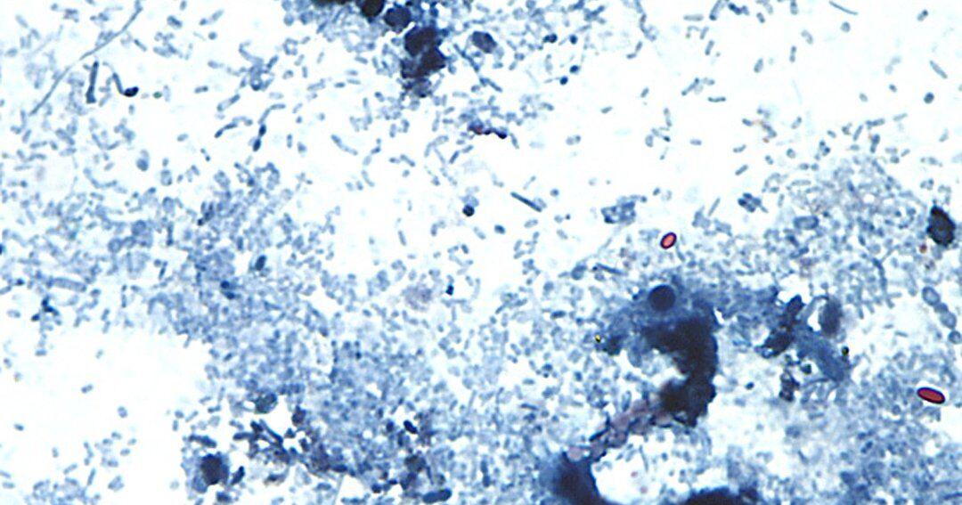 Outbreak of diarrhea-causing parasite grows to more than 1,000 cases - The Spec