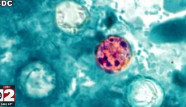 Michigan cyclosporiasis cases near 1,000; state launches webpage | Health