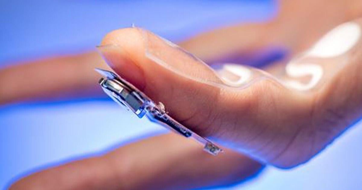 Sweat-powered patch tracks Parkinson’s patient medication levels | Health