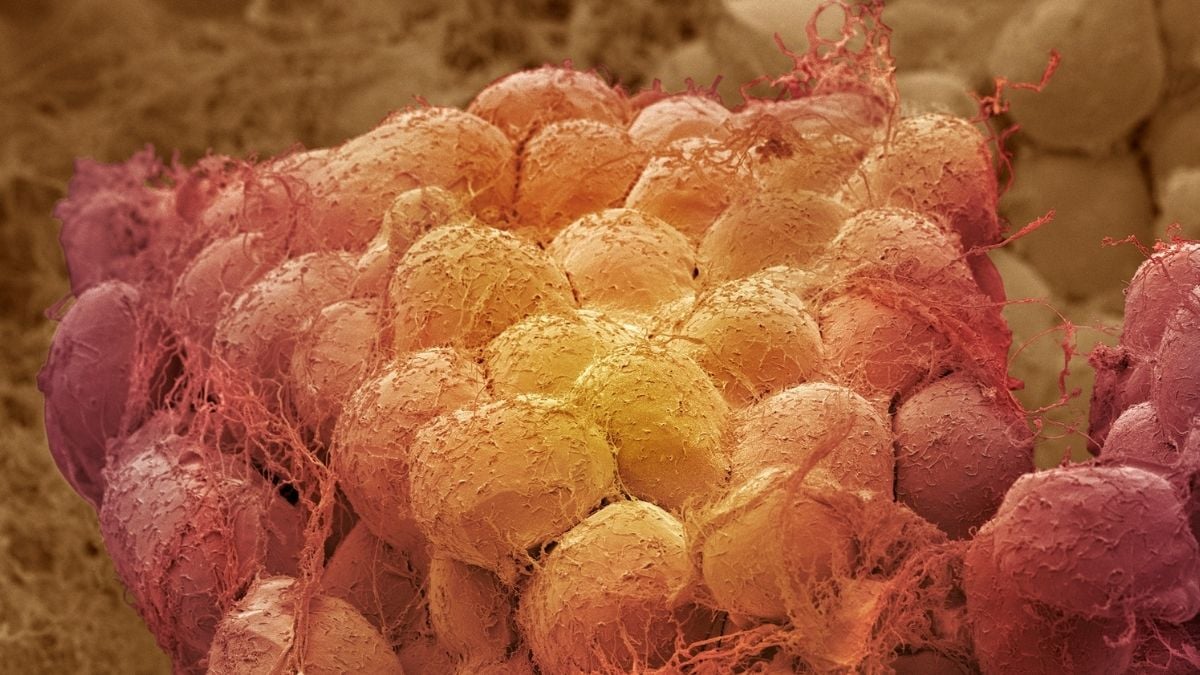 One Diet Helped Aging Mice Lose Fat While Preserving Muscle : ScienceAlert