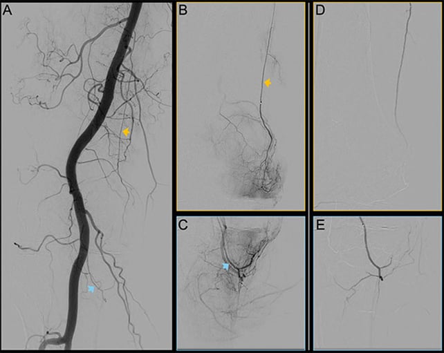 Blood vessel scans