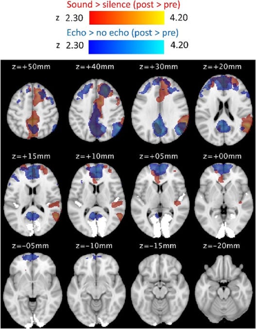 Brain charts