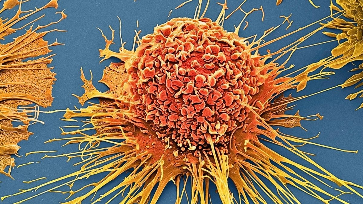 Scientists Destroy 99% of Cancer Cells in Lab Using Vibrating Molecules : ScienceAlert