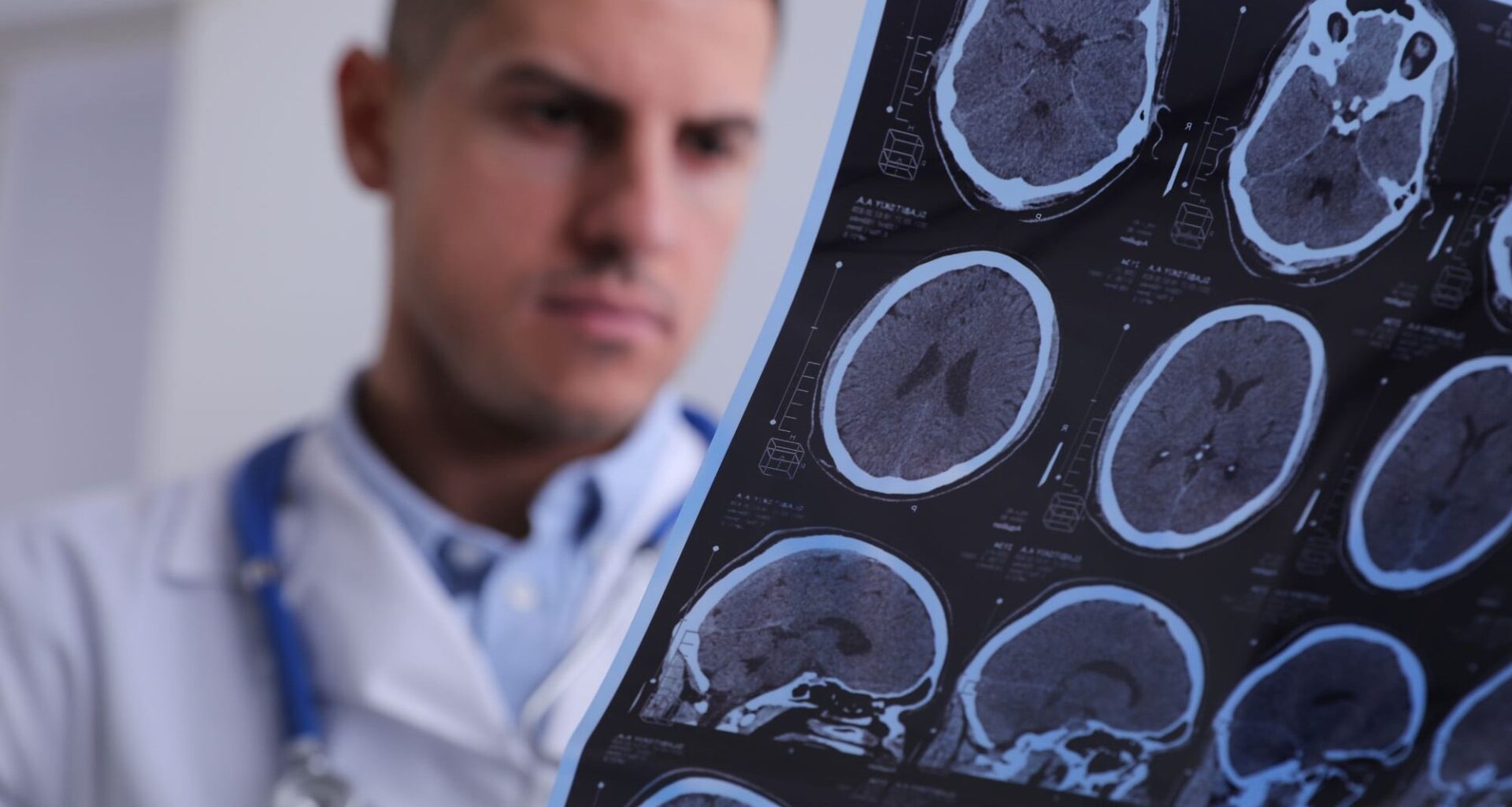 Doctor MRI Multiple Sclerosis