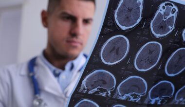 Doctor MRI Multiple Sclerosis