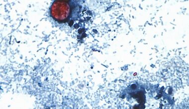 Cyclospora outbreaks: Canada not yet affected, officials say