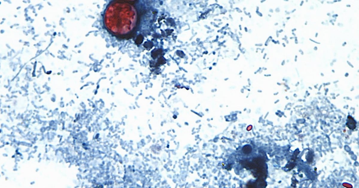 Cyclospora outbreaks: Canada not yet affected, officials say