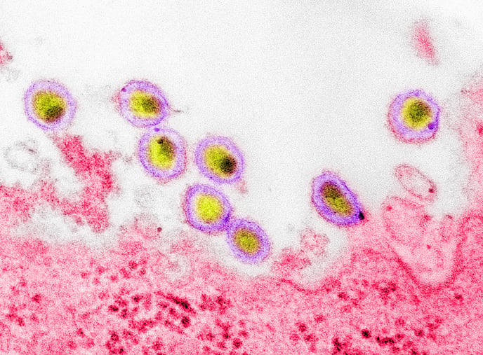 A New Kind of HIV Pill Just Passed Its First Test in Humans With HIV