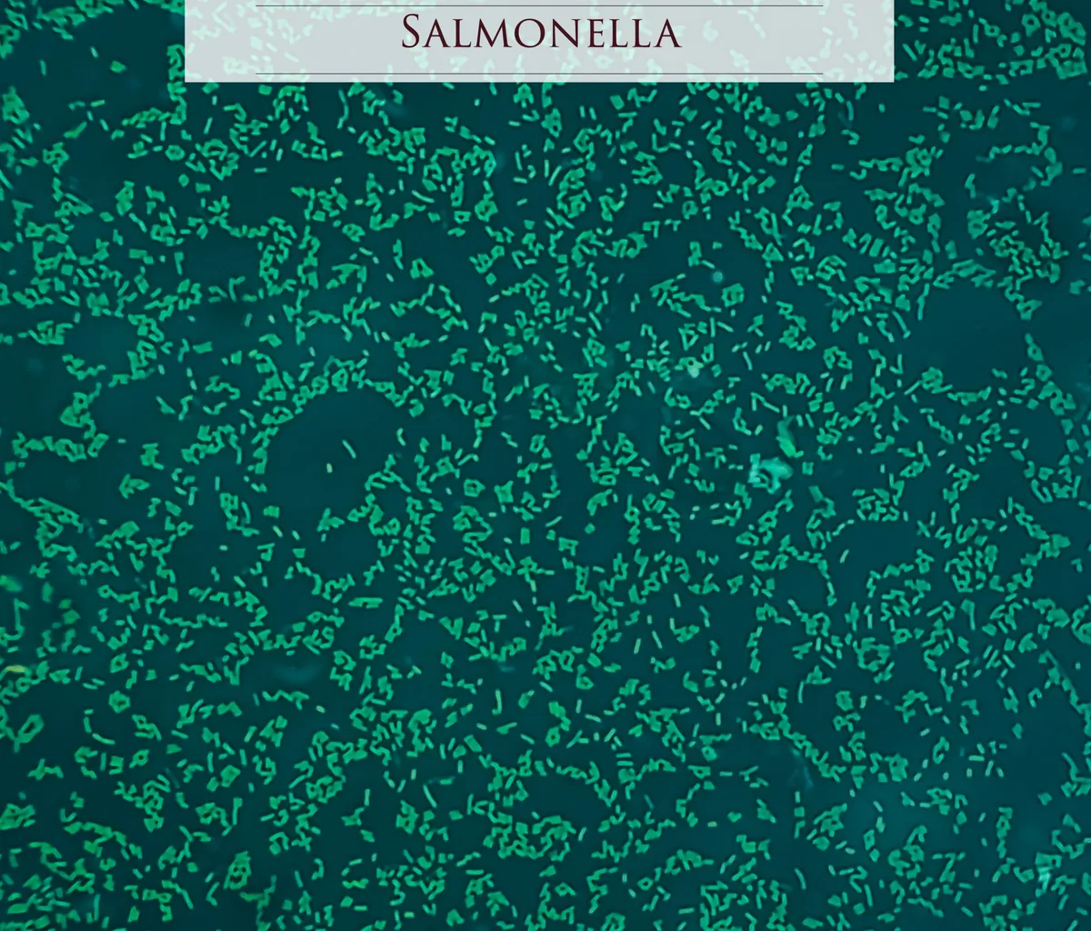 Microscopic view of gram stained slide from blood agar salmonella colonies
