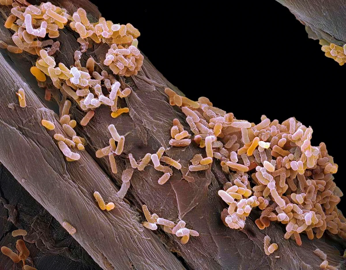 Salmonella bacteria. Coloured scanning electron micrograph (SEM) of Salmonella bacteria. 