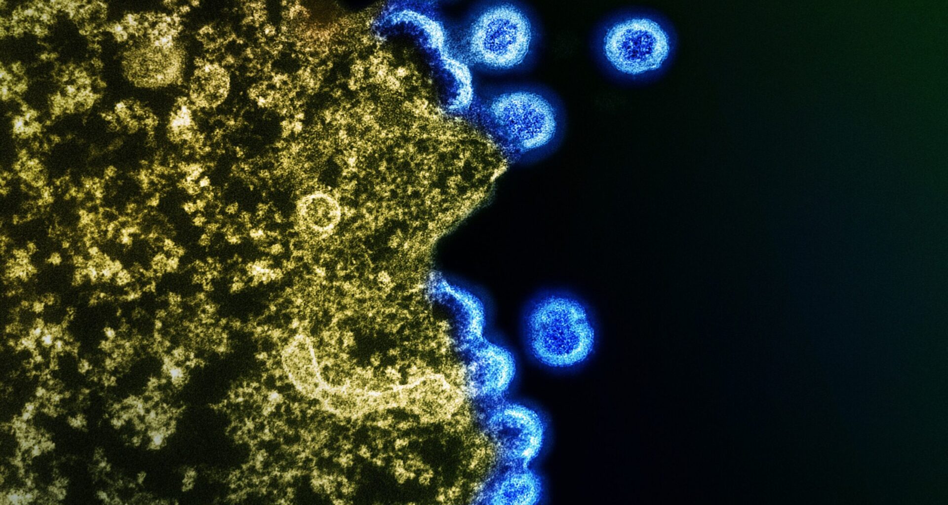 Evolution of Biological Information: HIV Evolution