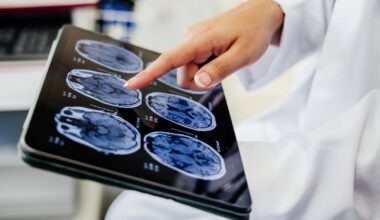 Review highlights tocotrienols for long-term neurovascular health