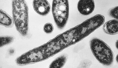 Legionnaires' outbreak: Met museum building tests positive