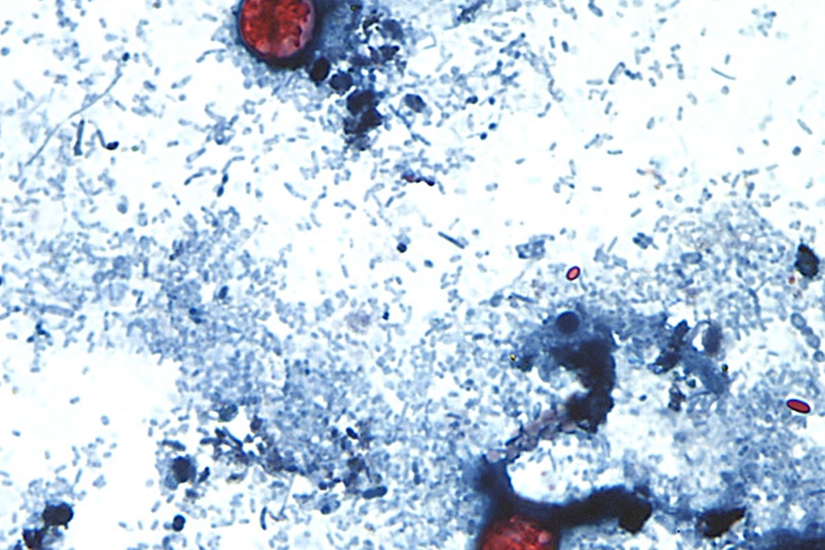 What Canadians need to know about cyclosporiasis, the gastrointestinal illness outbreak hitting the U.S.
