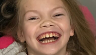 Cycling marathon aims to get young girl with rare condition mobile