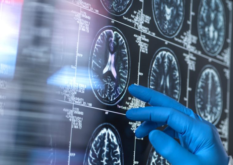 Brain scans