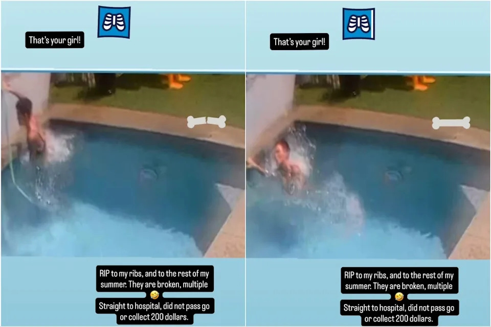 Rose shared footage of her injury on her Instagram Story (Ruby Rose/Instagram)