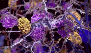 A Human-Safe Drug Reduces Multiple Signs of Alzheimer's in Mice : ScienceAlert