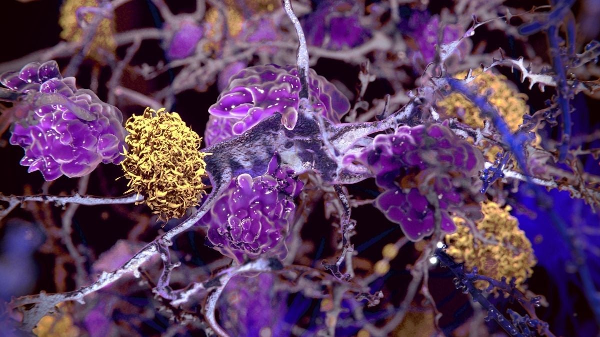 A Human-Safe Drug Reduces Multiple Signs of Alzheimer's in Mice : ScienceAlert