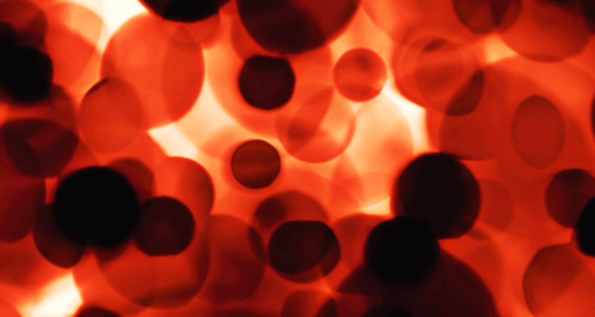 Lung Immune Cells Protect Against Respiratory Infections