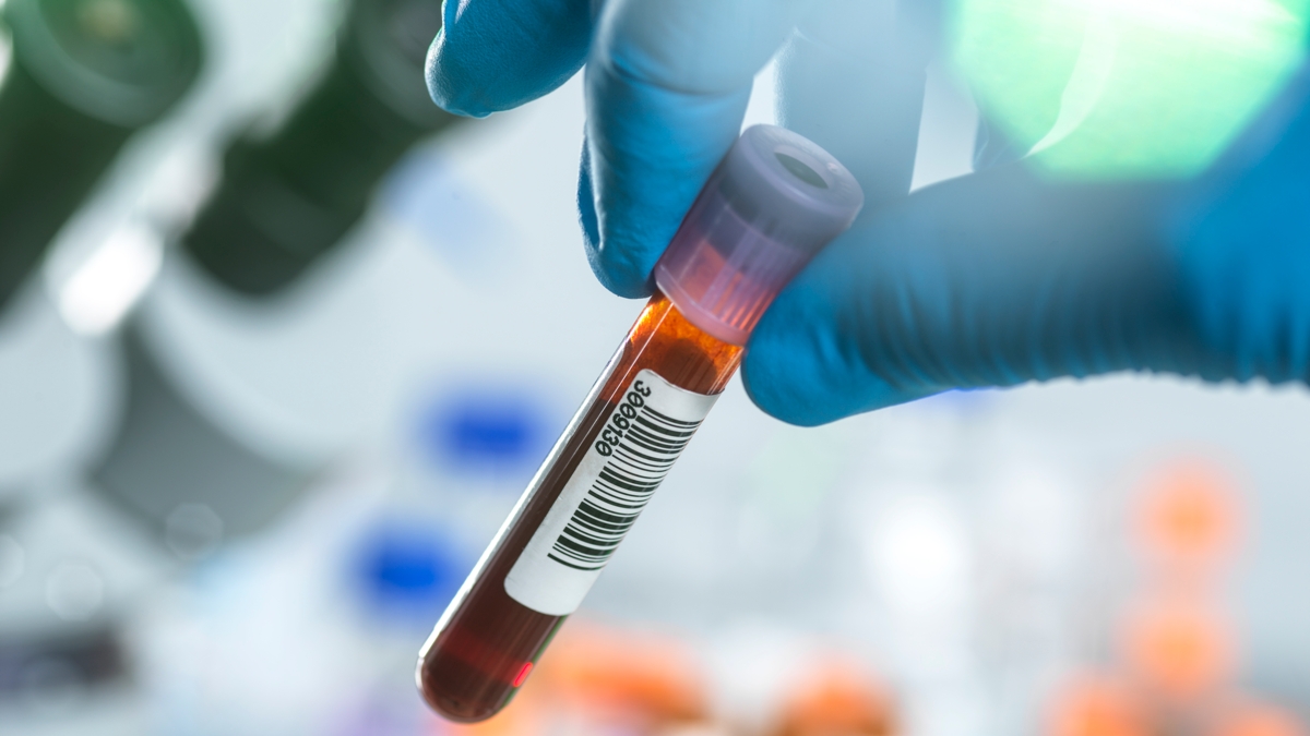 Scientists Identify a Hormone Spike Linked to Anorexia Nervosa : ScienceAlert