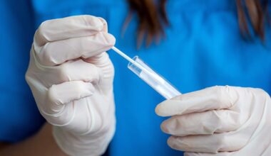 Spit test could shrink years-long wait for diagnosis that affects 190M women