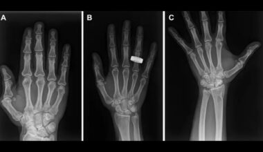 1st-ever X-rays in space offer hope for possible patients headed to the moon