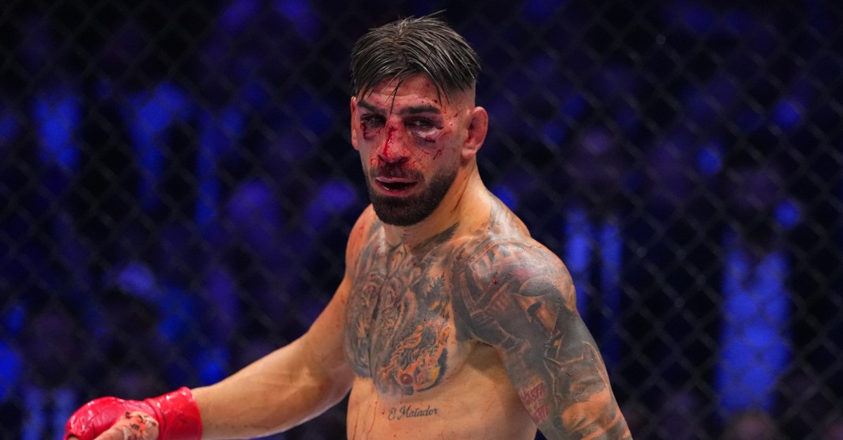 Ilia Topuria Shows Face After UFC Freedom 250 Loss