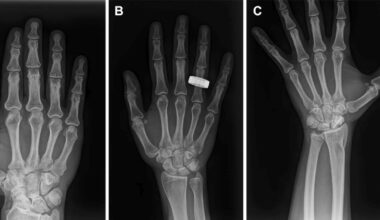 Astronauts Have Taken The First Human X‑Rays in Space : ScienceAlert