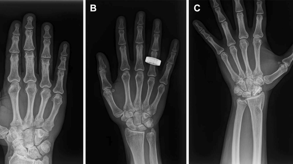 Astronauts Have Taken The First Human X‑Rays in Space : ScienceAlert