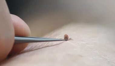 Concerns About Ticks Carrying Lyme Disease Growing Across Canada