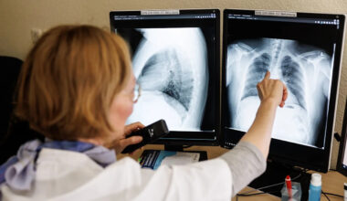 WHO warns global cancer cases could nearly double by 2050