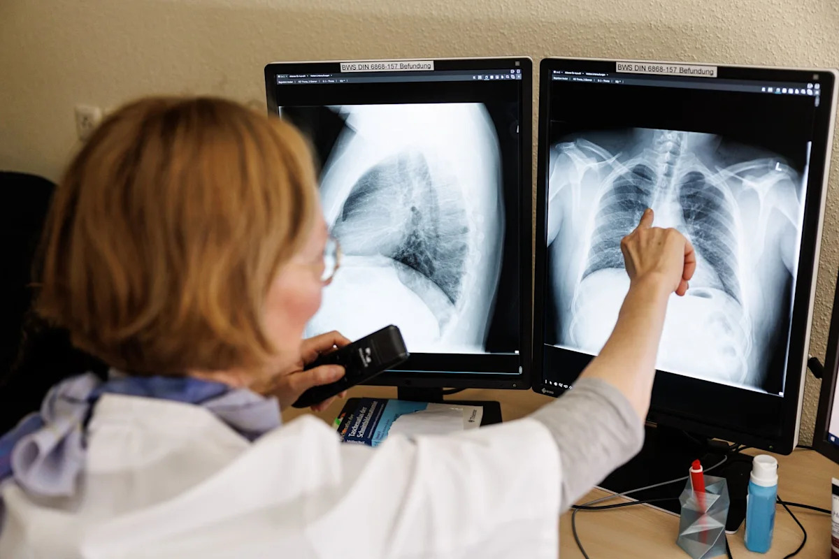 WHO warns global cancer cases could nearly double by 2050