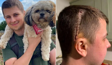 Man, 34, Was Sent Home from Hospital After 10-Day Migraine. Days Later, He Was Diagnosed with an Incurable Brain Tumor