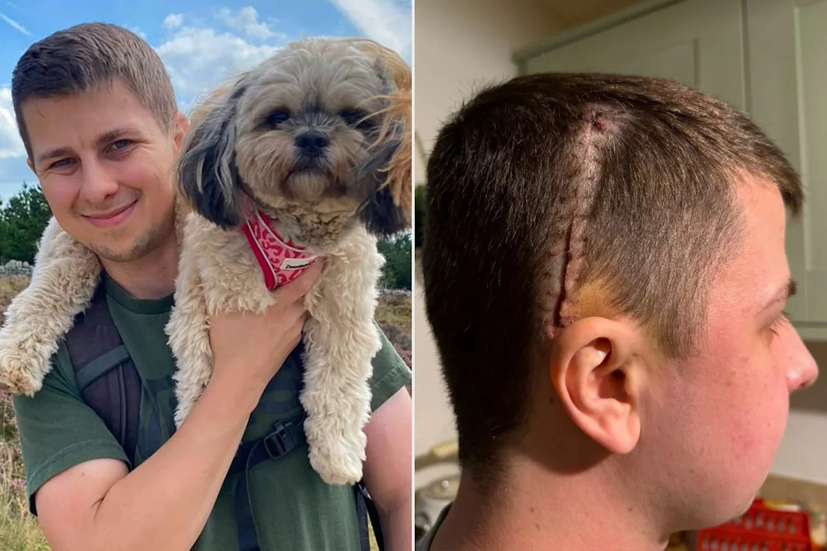 Man, 34, Was Sent Home from Hospital After 10-Day Migraine. Days Later, He Was Diagnosed with an Incurable Brain Tumor