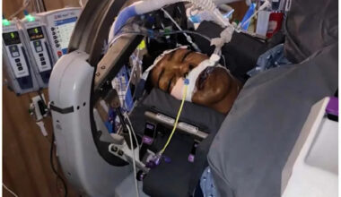Woman had legs amputated after cough turned into sepsis