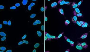 Alzheimer's Has Been Killing Brain Cells in a Way Scientists Have Never Understood