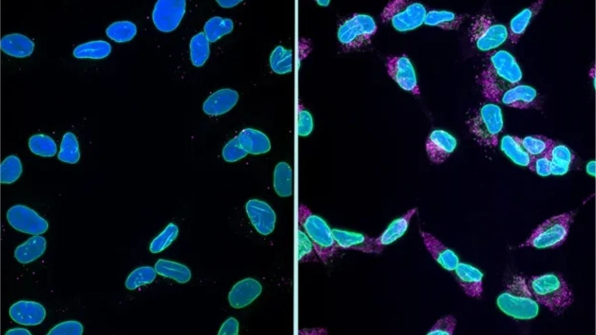 Alzheimer's Has Been Killing Brain Cells in a Way Scientists Have Never Understood