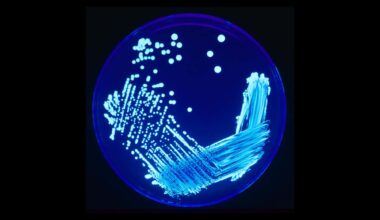 Legionnaires' Cluster Kills Five in New York City