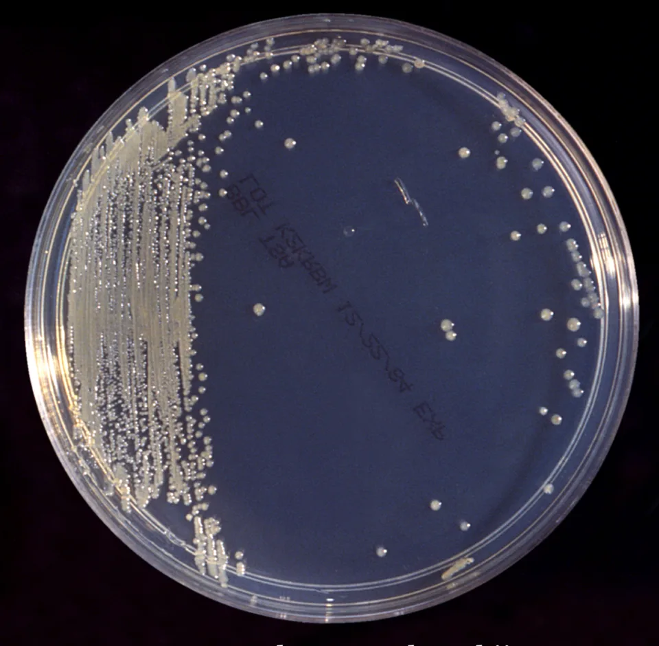 This inoculated trypticase soy broth (TSB) agar cultivated colonial growth of Enterobacter sakazakii bacteria that were slightly yellowish in color.