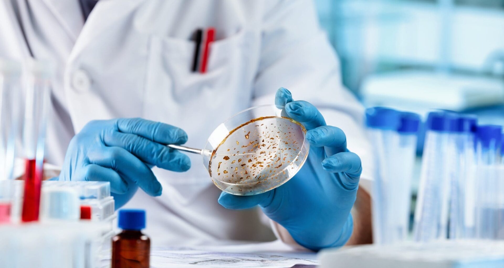 Antifungal drugs breakthrough tackles drug-resistant infections