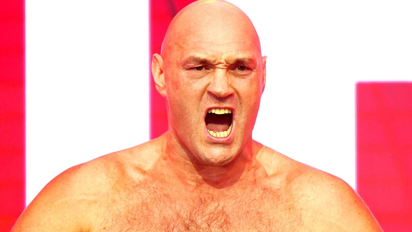 Tyson Fury