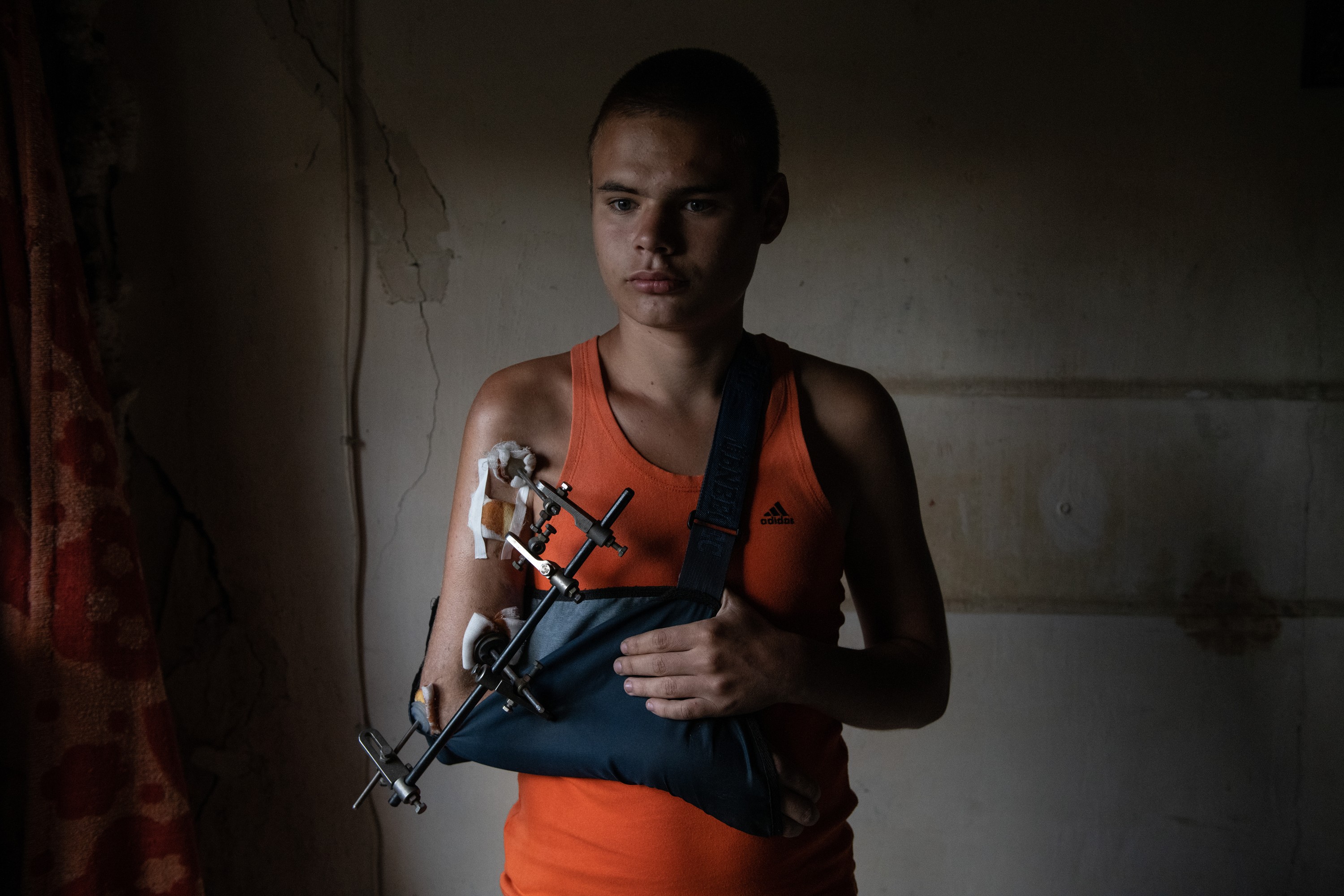 A young man wearing an orange tank top stands in a dimly lit room, looking downward with a somber expression while his injured arm is supported by an external fixation medical device and a sling
