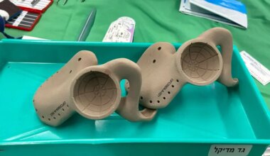 Medical History: Israeli surgeons replace teenager’s pelvis in 19-hour operation