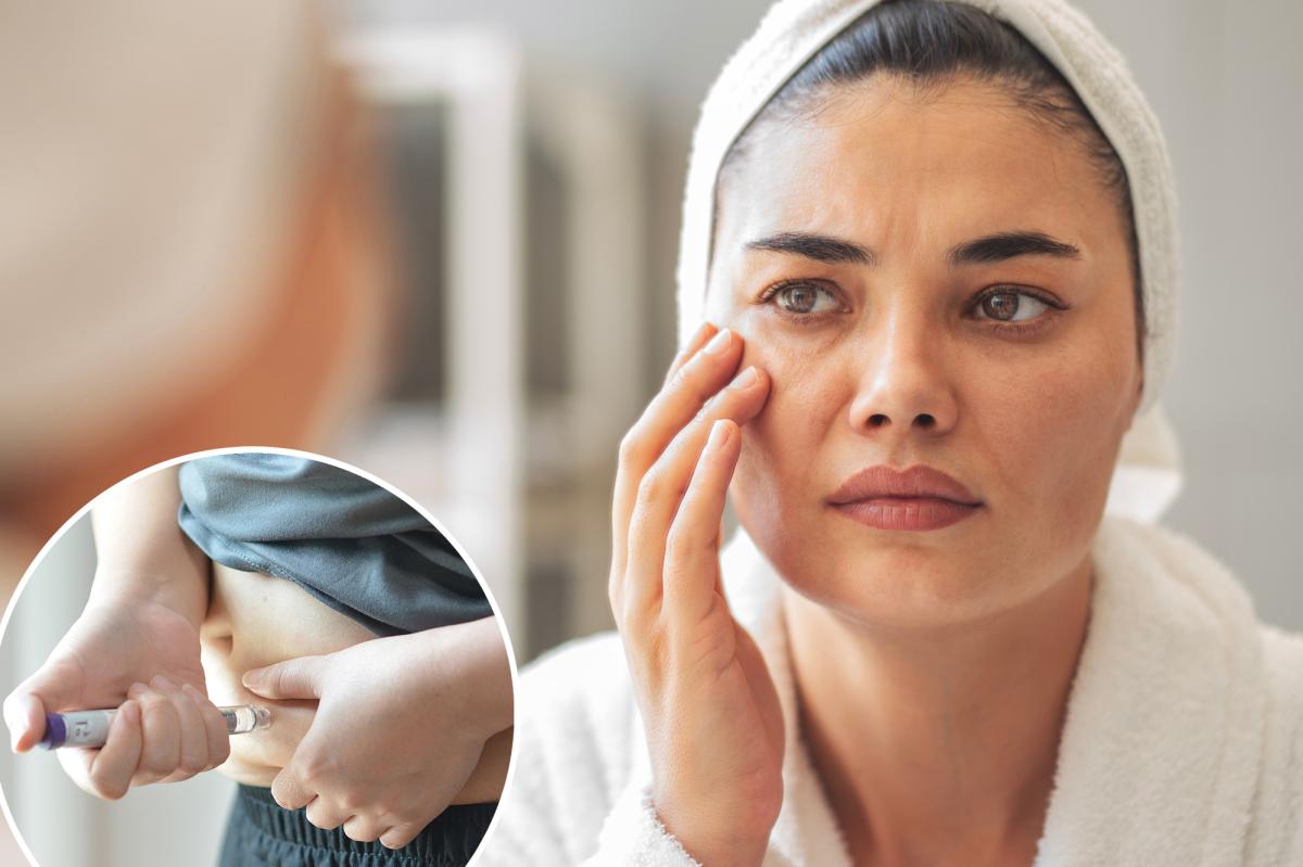 'Temporal wasting': GLP-1 side effect making patients look older